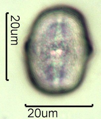 Yellow Sweet Clover Pollen Under the Microscope