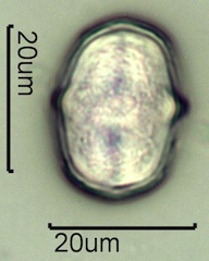Yellow Sweet Clover Pollen Under the Microscope
