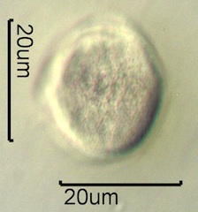 Yellow Sweet Clover Pollen Under the Microscope