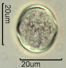 Yellow Sweet Clover Pollen Under the Microscope