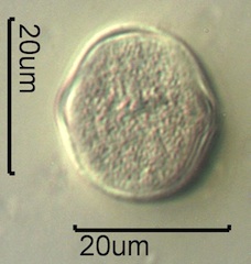 Yellow Sweet Clover Pollen Under the Microscope