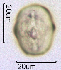 Yellow Sweet Clover Pollen Under the Microscope