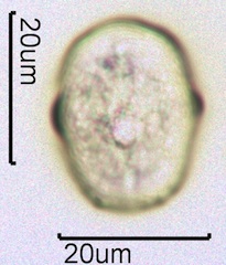 Yellow Sweet Clover Pollen Under the Microscope