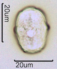 Yellow Sweet Clover Pollen Under the Microscope
