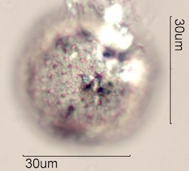 Zygocatus (Schlumbergera Truncata Group) Pollen