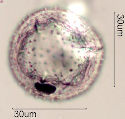 Zygocatus (Schlumbergera Truncata Group) Pollen