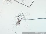Chaetomium
