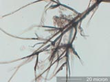 Chaetomium Hyphaesetae