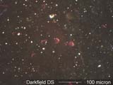 Darkfield Dispersion Staining