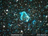 Darkfield Dispersion Staining