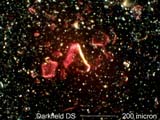 Darkfield Dispersion Staining