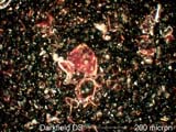 Darkfield Dispersion Staining