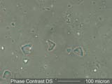 Phase Contrast Dispersion Staining