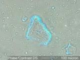 Phase Contrast Dispersion Staining