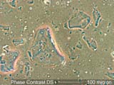 Phase Contrast Dispersion Staining