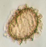 Fern Spore