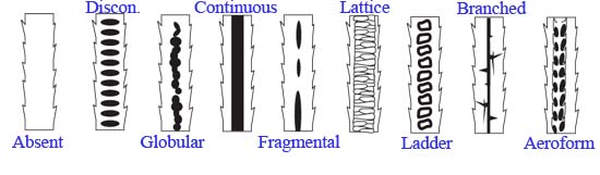 Medulla Patterns