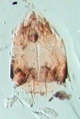 Mite Leg