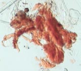 Mite