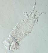 Demodex folliculorum