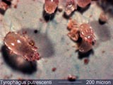 Tyrophagus Mite