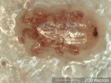 Mite
