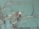 Mite Leg