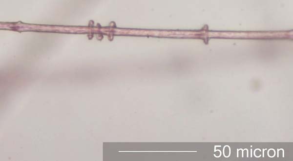 Pheasant (Phasianidae) Under the Microscope