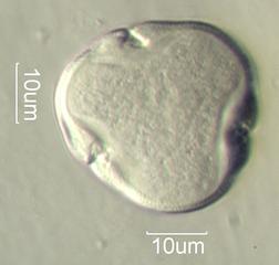American Basswood (Tilia americana) Pollen under the Microscope