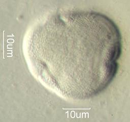 American Basswood (Tilia americana) Pollen under the Microscope