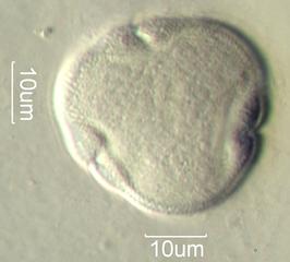 American Basswood (Tilia americana) Pollen under the Microscope