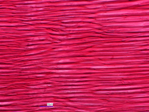 Acer saccharinum, Radial Section