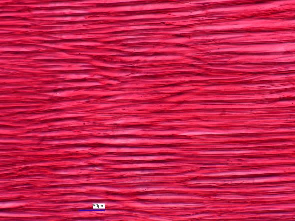 Acer saccharinum, Radial Section