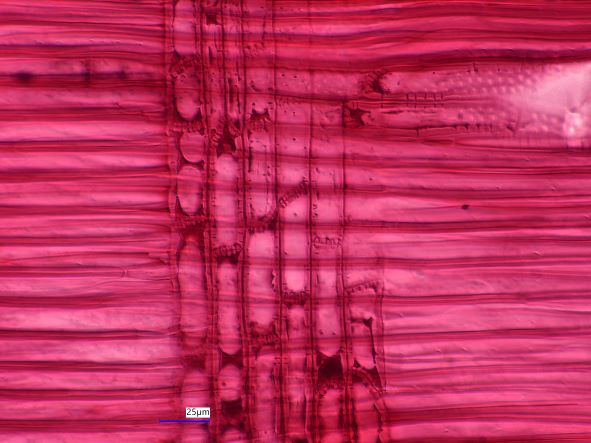Acer saccharinum, Radial Section