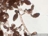 Ulocladium